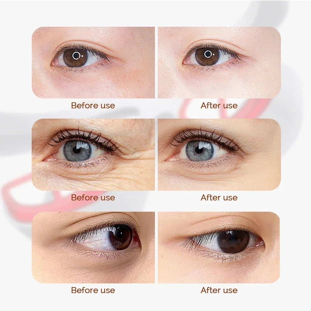 https://ae-pic-a1.aliexpress-media.com/kf/S8ff4d82c0403408d88a268aeae6eae45j.jpg_500x500.jpg_.webp
